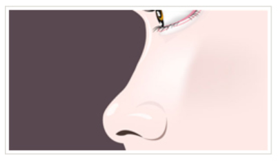 KOKO美容外科での鼻整形についての参考画像。低い鼻を横から見たイラスト。