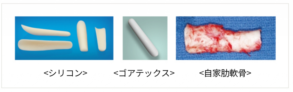 KOKO美容外科で使用されているシリコン、ゴアテックス、自家肋軟骨の写真。左からシリコン、ゴアテックス、自家肋軟骨。