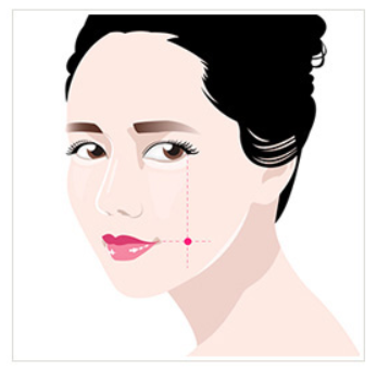 韓国ココ美容外科であなただけの可愛さポイントであるえくぼを確実に顔と自然に作ってみてください。