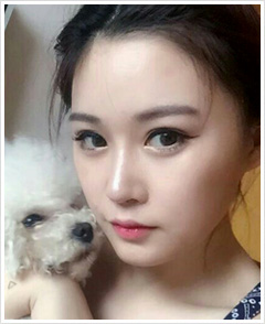ココ美容外科の鼻整形リアルモデルの自撮り写真です。 右から左に向かって斜めに眺めていて、顔の右側には白い子犬がモデルを眺めています。
