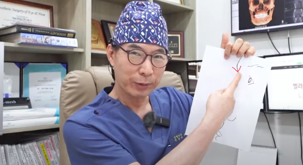 Head Surgeon explaining about the ideal nose shape of a male | Korea's Top Nose Revision Specialist