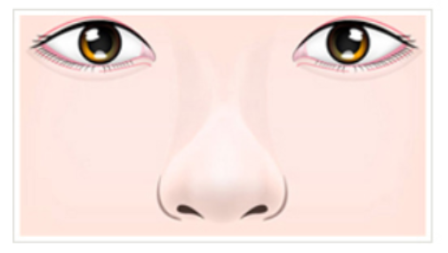 団子鼻のイメージ画像。小鼻の部分が広く広がっていてゆったりとした印象を与えてしまう。