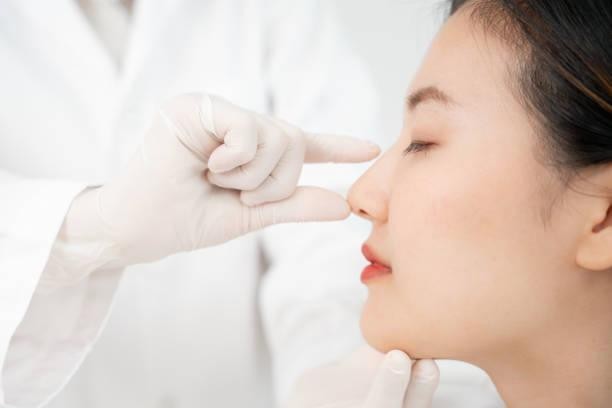 KOKO美容外科での小鼻縮小についての参考画像