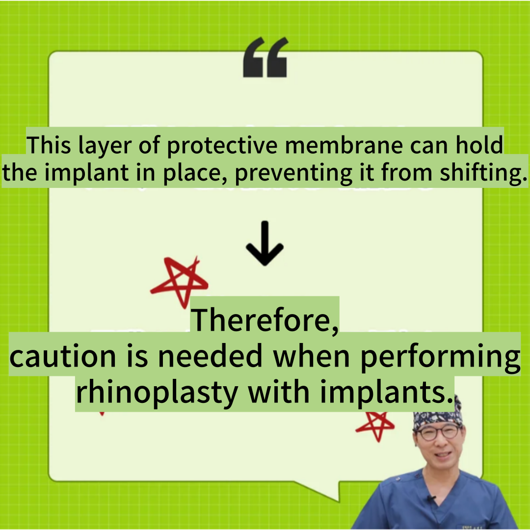 rhinoplasty with implants