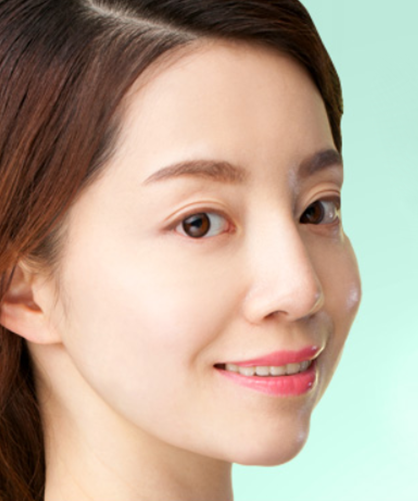  | Korea's Top Nose Revision Specialist | Korea's Top Nose Revision Specialist