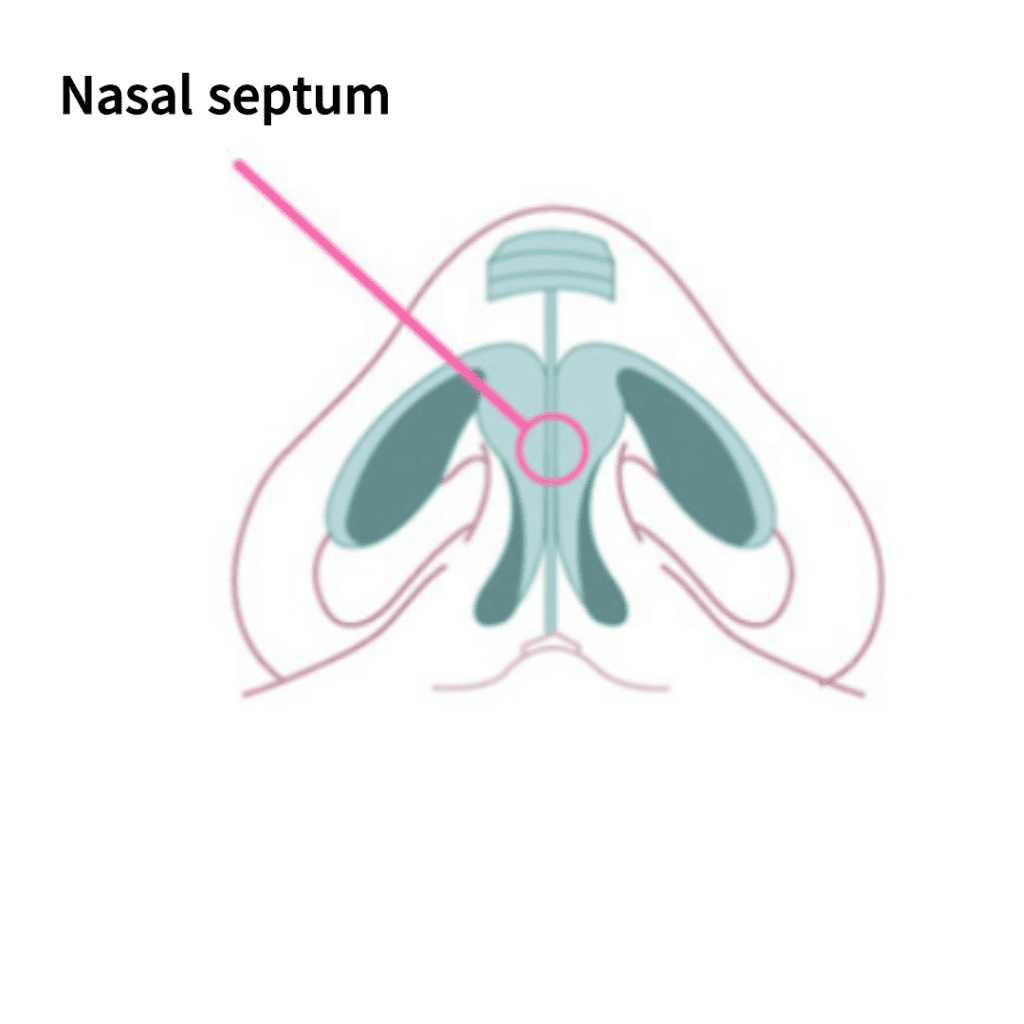 Tip rhinoplasty utilizing nasal dorsal augmentation with grafting | Korea's Top Nose Revision Specialist