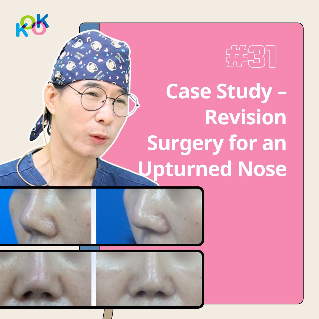  | Korea's Top Nose Revision Specialist