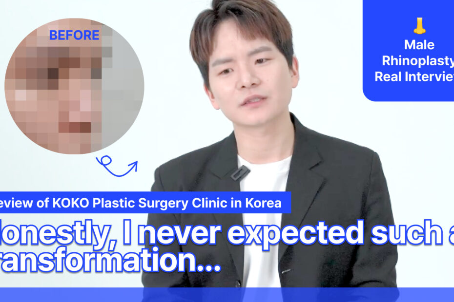 A promotional video thumbnail titled "Review of KOKO Plastic Surgery Clinic in Korea." On the left, a pixelated "before" photo shows a man's nose profile. On the right, the man is shown after his procedure with a more defined nose. Large white text at the bottom reads, "Honestly, I never expected such a transformation..." A blue badge in the corner says "Male Rhinoplasty Real Interview."