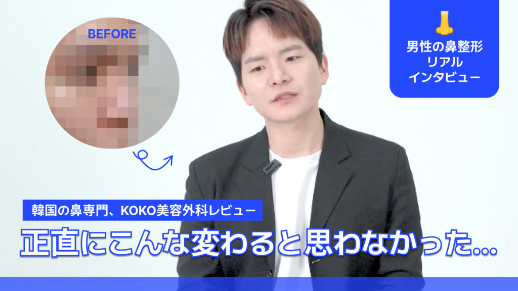 韓国の鼻整形専門、KOKO美容外科のレビュー動画のサムネイル画像。 中央: 整形手術を終えた男性が正面を向いて座っている姿。 左上: 「BEFORE」という文字と共に、整形前の鼻の部分がモザイク処理された円形の比較画像。 右上（青いボックス）: 鼻のアイコンと共に「男性の鼻整形 リアルインタビュー」というテキスト。 下部（青い背景に白文字）: 「韓国の鼻専門、KOKO美容外科レビュー」という説明。 最下部（大きな白文字）: 「正直にこんな変わると思わなかった…」という男性の感想が強調されている。 | Korea's Top Nose Revision Specialist