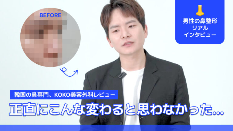 韓国の鼻整形専門、KOKO美容外科のレビュー動画のサムネイル画像。 中央: 整形手術を終えた男性が正面を向いて座っている姿。 左上: 「BEFORE」という文字と共に、整形前の鼻の部分がモザイク処理された円形の比較画像。 右上（青いボックス）: 鼻のアイコンと共に「男性の鼻整形 リアルインタビュー」というテキスト。 下部（青い背景に白文字）: 「韓国の鼻専門、KOKO美容外科レビュー」という説明。 最下部（大きな白文字）: 「正直にこんな変わると思わなかった…」という男性の感想が強調されている。