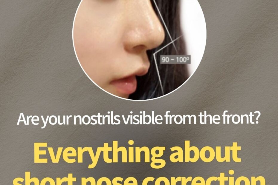 A promotional image for KOKO Plastic Surgery Clinic. In the center, there is a circular photo of a woman's side profile overlaid with lines showing the ideal nasal angles: 115~130 degrees and 90~100 degrees. Below the photo, the text reads "Are your nostrils visible from the front?" in white, followed by "Everything about short nose correction" in large yellow letters. At the bottom, there is a yellow button that says "Check the golden ratio here