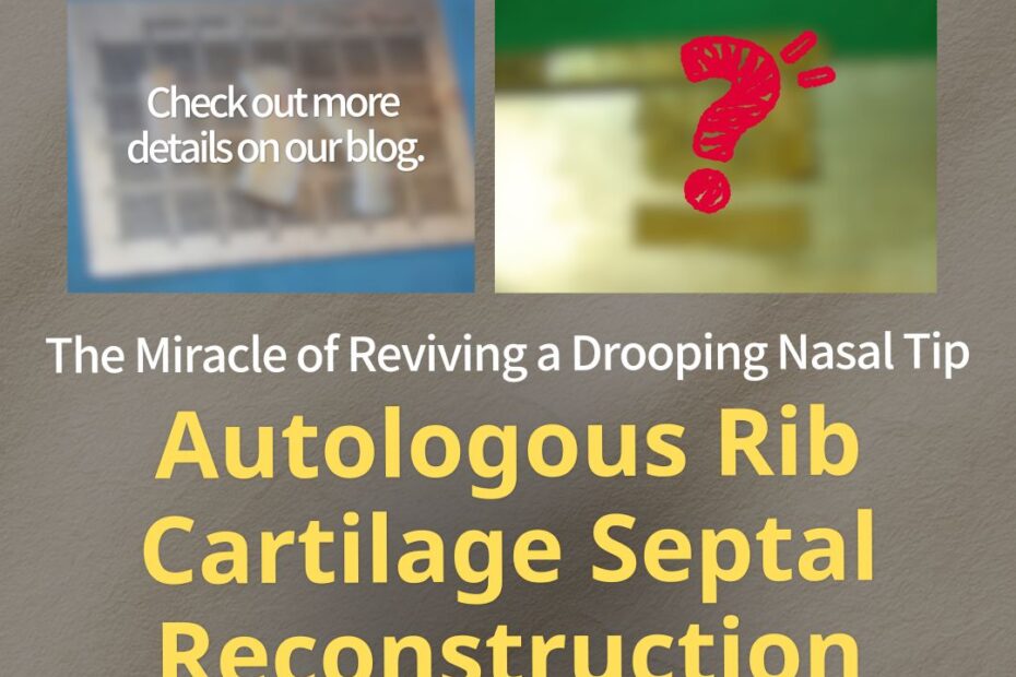 Promotional image for KOKO Plastic Surgery Clinic. The top features two blurred preview images—one of surgical materials and another with a red question mark. The main text reads, "The Miracle of Reviving a Drooping Nasal Tip," followed by large yellow text stating, "Autologous Rib Cartilage Septal Reconstruction." At the bottom, there is a yellow button that says, "Check the Ingredients >>".