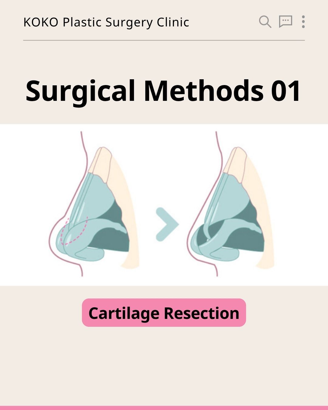  | Korea's Top Nose Revision Specialist