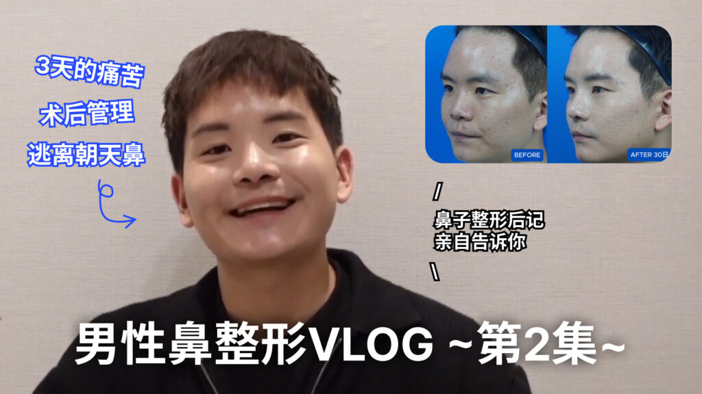  | Korea's Top Nose Revision Specialist