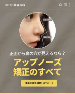 KOKO美容外科のプロモーション画像。上部に「KOKO美容外科」のロゴがあり、中央には理想的な鼻の角度を示した女性の横顔の写真が丸く切り取られて配置されています。その下に大きく「正面から鼻の穴が見えるなら？ アップノーズ矯正のすべて」というテキストがあり、一番下には「黄金比率を確認しに行く ≫」と書かれたボタンが配置されています。