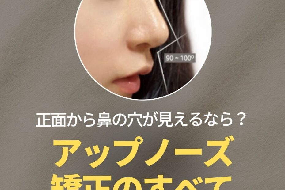 KOKO美容外科のプロモーション画像。上部に「KOKO美容外科」のロゴがあり、中央には理想的な鼻の角度を示した女性の横顔の写真が丸く切り取られて配置されています。その下に大きく「正面から鼻の穴が見えるなら？ アップノーズ矯正のすべて」というテキストがあり、一番下には「黄金比率を確認しに行く ≫」と書かれたボタンが配置されています。