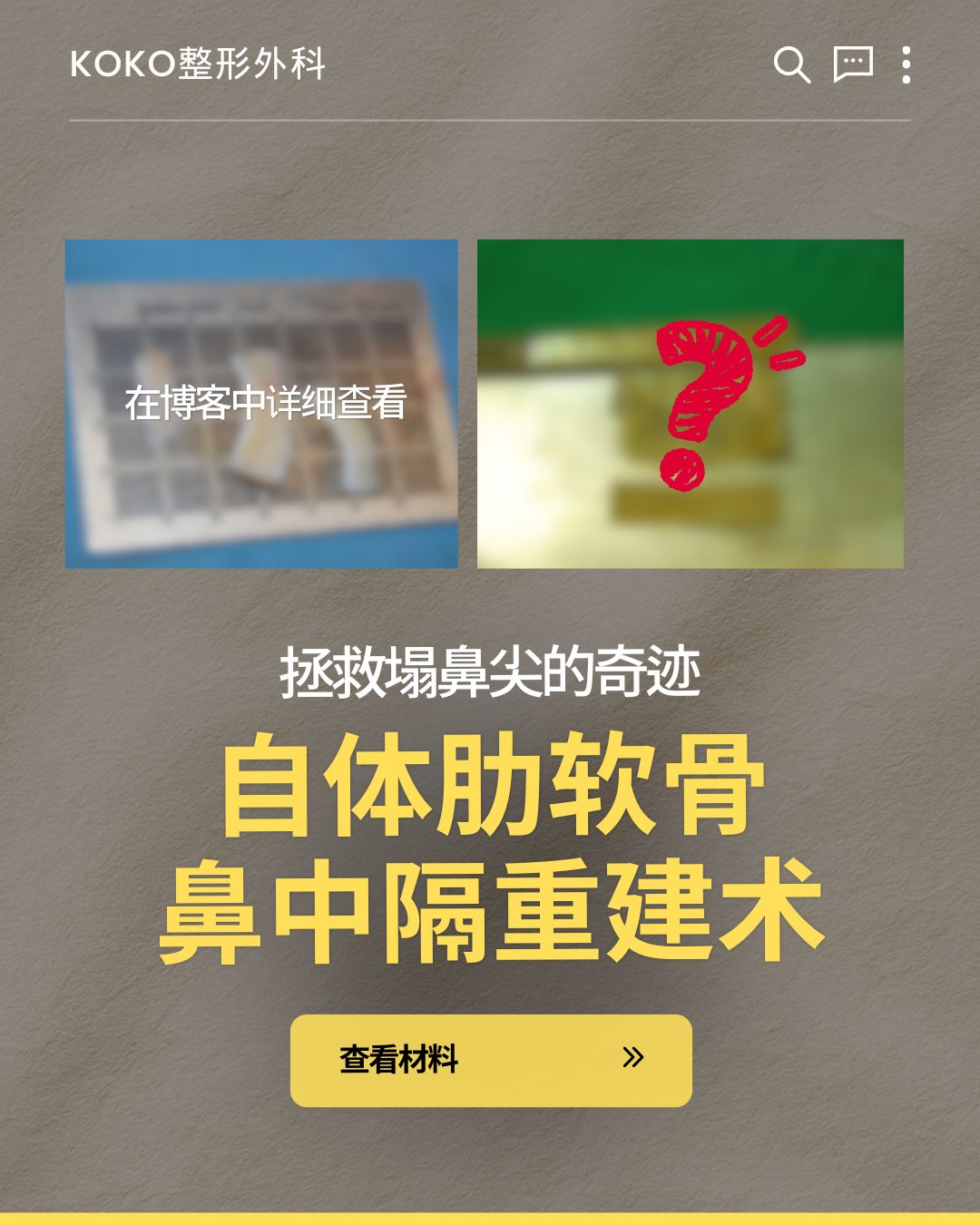  | Korea's Top Nose Revision Specialist