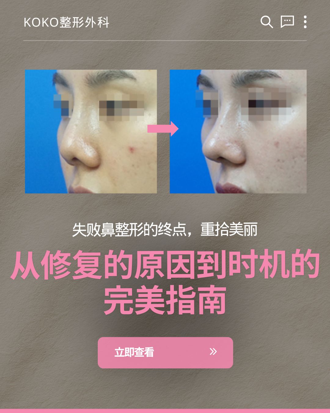 KOKO整形外科鼻修复宣传图。画面中央是一组女性鼻部整形前后的侧脸对比照，中间有粉色箭头指示。图片下方带有大号宣传标语：“失败鼻整形的终点，重拾美丽”以及“从修复的原因到时机的完美指南”。最下方有一个粉色的“立即查看 >>”按钮。 | Korea's Top Nose Revision Specialist