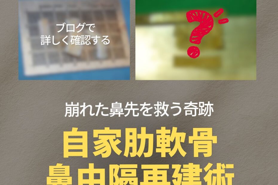 KOKO整形外科的宣传海报。主标题为“拯救塌鼻尖的奇迹 自体肋软骨 鼻中隔重建术”，底部有一个带有“查看材料”字样的黄色按钮。上方配有两张配图，左侧模糊的网格图上写着“在博客中详细查看”，右侧图为一个红色的手绘问号。