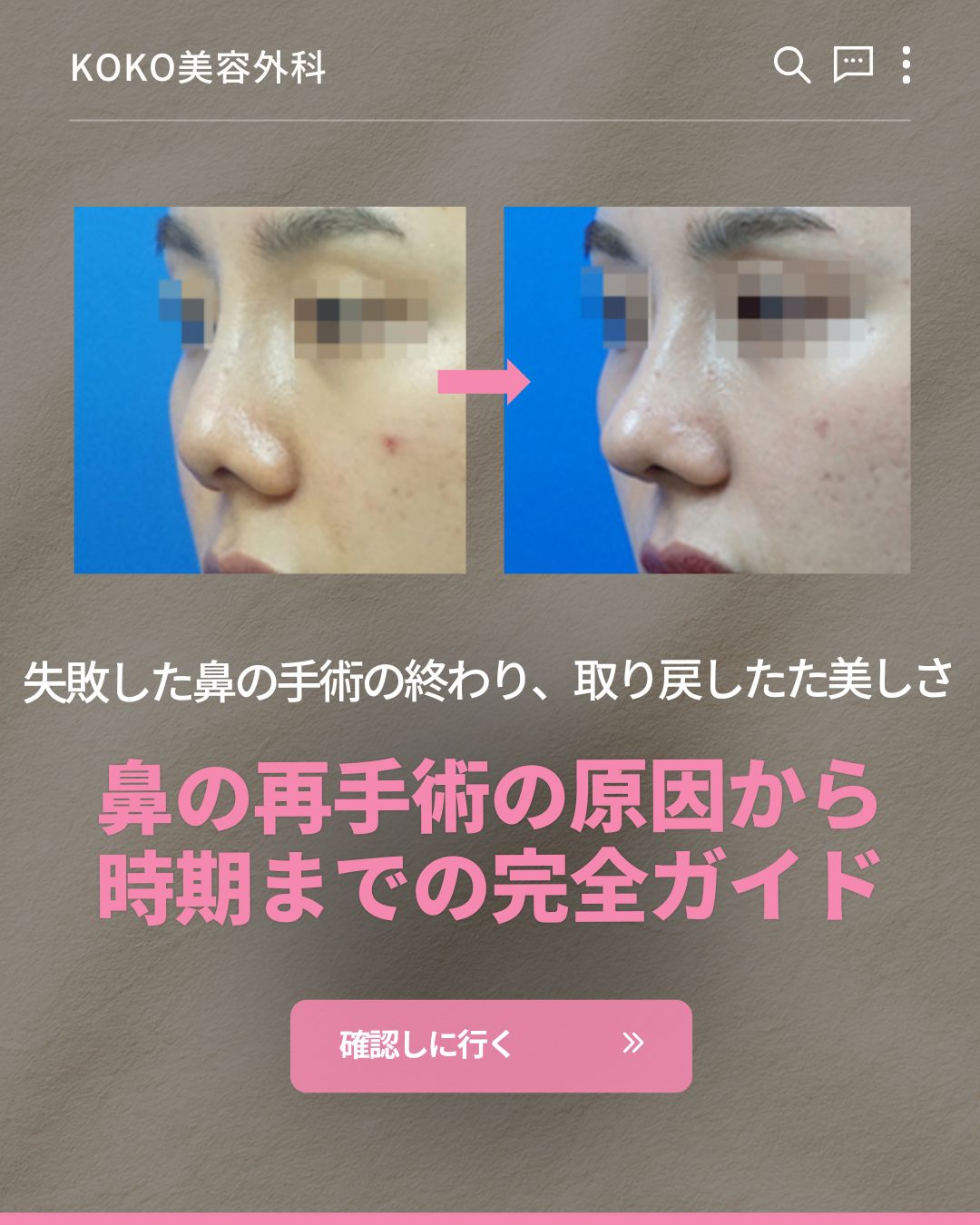 鼻の再手術の原因から時期までの完全ガイド 1 | Korea's Top Nose Revision Specialist KOKO美容外科「鼻の再手術の原因から時期までの完全ガイド」の案内画像。女性の鼻のビフォーアフター写真とともに、「失敗した鼻の手術の終わり、取り戻した美しさ」というキャッチコピーと「確認しに行く」ボタンが配置されている。